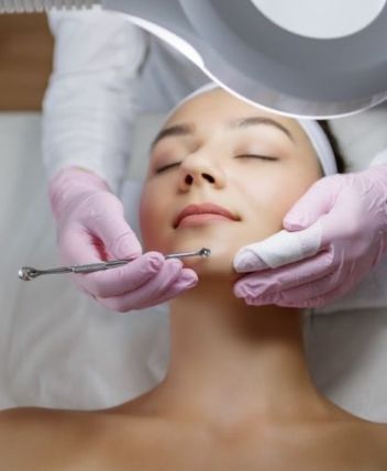 extracción de comedones